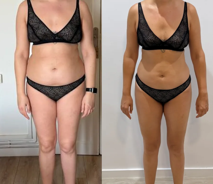 Transformaci&oacute;n clienta