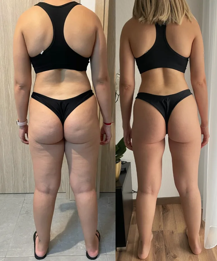 Transformaci&oacute;n clienta